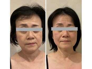 ドクターボディクリスタル(Dr.Body Crystal)/50代