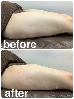 ギンザアール(GINZA R.)/下半身に徹底アプローチ◎