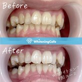 ホワイトニングカフェ 本厚木店