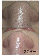 メディカルエステ ユウ(Yuu)/