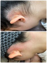 サロンエム 西荻窪(salon M)/うなじワックス×光脱毛