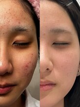 ビー イオンモール小山店(Be...)&nbsp;田口 心詩