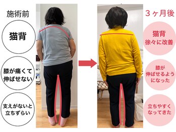いろどり整体/【７０代女性】猫背、膝痛改善