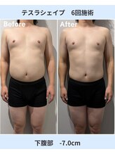 アーヒル 富山店(A”-HILU)/