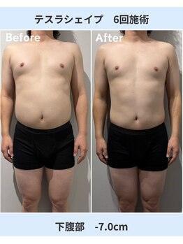 アーヒル 富山店(A”-HILU)/