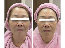 美 ウツクシ(美 U.tsu.ku.shi)/女性理容師さん、プラズマ初体験