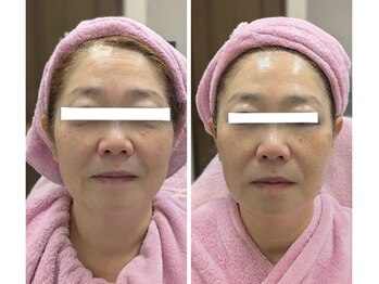 美 ウツクシ(美 U.tsu.ku.shi)/女性理容師さん、プラズマ初体験