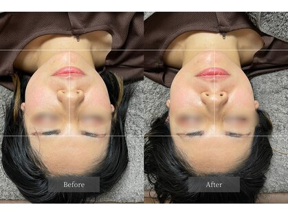 ユー(U.)の写真