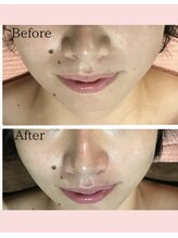 ユルリ 水戸本店(yururi)/＼＼フェイシャルも大人気／／♪