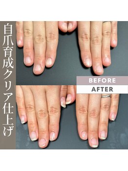 プリンチペッサジゼル/深爪矯正、自爪育成、ネイルケア