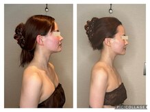 オント(ONTO)/人気セットメニュー