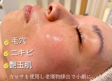 ヴェルソー(Verseau)