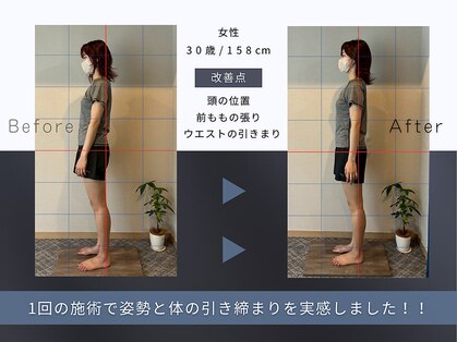 ボディーズ(Bodyis)の写真
