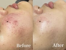 マシェ バイ マユ(Mache by Mayu)/みるみる良くなっていく☆