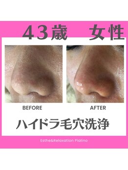 ピアリーノ(Pialino)/