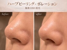 ビューティーサロン プティ(beauty salon petite)