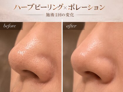 ビューティーサロン プティ(beauty salon petite)の写真