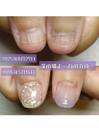 深爪、美爪育成、自爪育成
