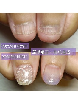 マニエネイル(mani e nail)/ 深爪、美爪育成、自爪育成