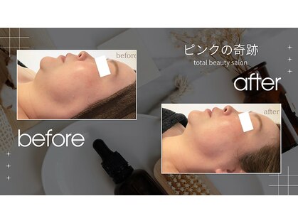ピンクの奇跡の写真