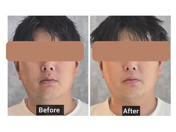 ととのえる。の写真/夏の清潔感は今作る!男の肌ケア&疲れ解放+極上ヘッドスパで疲れもリセット