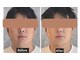 ととのえる。の写真/夏の清潔感は今作る!男の肌ケア&疲れ解放+極上ヘッドスパで疲れもリセット