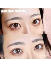 アニー(ANNIE)/ハリウッドブロウリフト