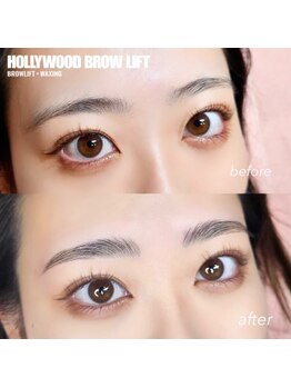 アニー(ANNIE)/ハリウッドブロウリフト