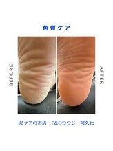 ピーアンドオー(P&O)/