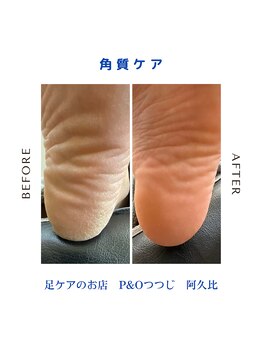ピーアンドオー(P&O)/