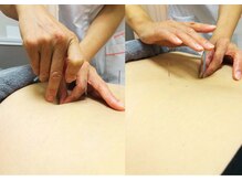 柏鍼灸整骨院/鍼灸施術