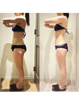 アユアランリンク 札幌店/20代前半/2ヵ月-6kg/側面