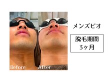 メンズビオ 神戸三宮店/