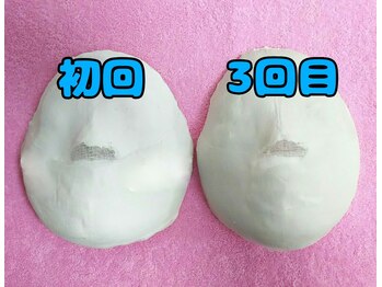 コルギサロン ベルエット(bell'et)/初回と3回目の比較です☆