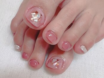 スマイルニコ(smile nico)の写真/サンダルでも自信が持てる☆フット深爪矯正◎ジェルで自然で美しい形に整えて深爪の見た目が変わります！