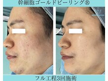 リメイククリニカルビューティー(Remake clinical beauty)/