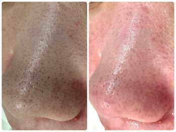 サイセイ(SAISEI)/