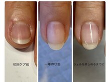 ガサガサさんの爪。一度のケアですっきり！爪ケアを日常に♪