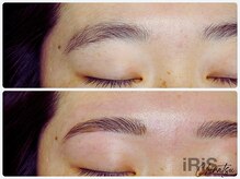 アイリス ビューティーサロン(iRiS Beayty salon)/下がり眉解消
