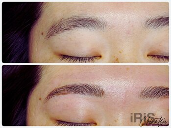 アイリス ビューティーサロン(iRiS Beayty salon)/下がり眉解消