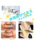 地域発！【水光ボツリヌスフェイシャル】速攻毛穴レス！艶肌爆誕♪￥20000→