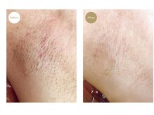 ユニヴェール(univers)の雰囲気（毛の悩みに寄り添いサポート出来る様丁寧なカウンセリングと施術）