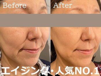 ココモンド(COCOMONDO)の写真/40～50代女性が絶賛◆内側から押し上げるハリ・ツヤ実現。大人女性の肌投資は土台から立て直す「細胞ケア」