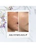 【本気肌改善】スキンケアご相談