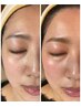 美肌脱毛facialWax♪プロの技で理想的な眉毛に！最後イオン導入で保湿￥7900