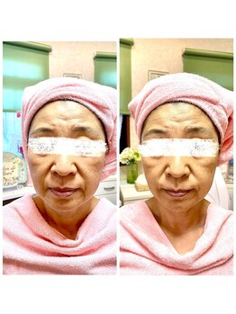 サロン ド フルール/【60代】ビフォーアフター