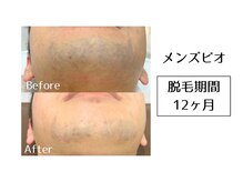 メンズビオ 神戸三宮店/