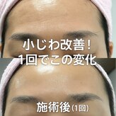 モアサロン(MOA salon)