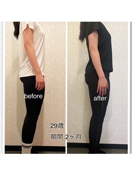 24ダイヤモンドジム(24 DIAMOND GYM)/before/after