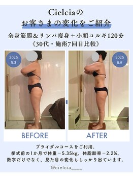 シェルシア(Cielcia)の写真/見た目を変えたいならコレ！徹底痩身でサイズダウンを実感♪脂肪・浮腫みを撃退して理想の体型を作ります◎